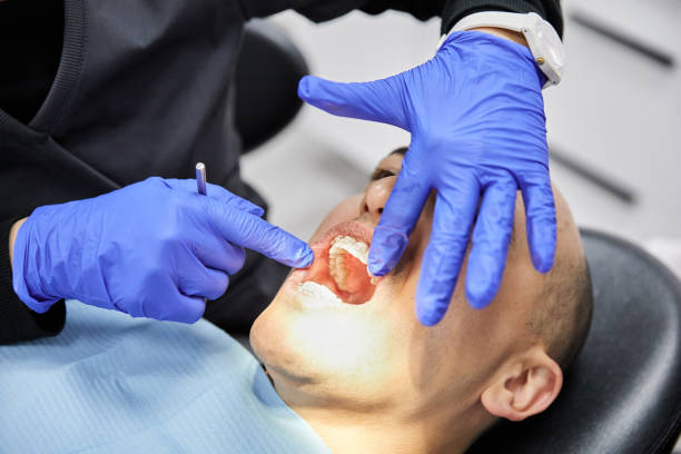 Best Emergency Dental Care for Sports Injuries in Somonauk, IL